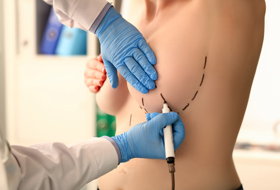 Lipofilling Gesicht