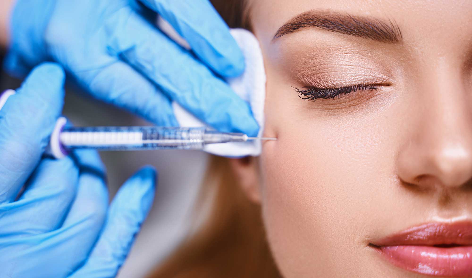 Lipofilling Gesicht